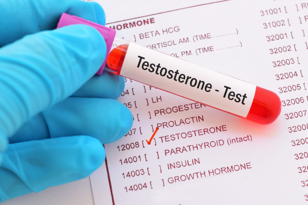 Testosteron